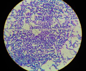 Gram positive bacilli with spor forming.