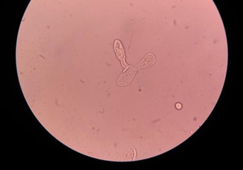 Close up epithelial cells  in urine sediment.