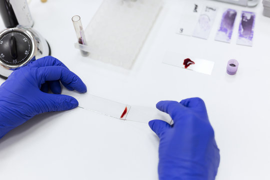 Blood samples being tested in a lab