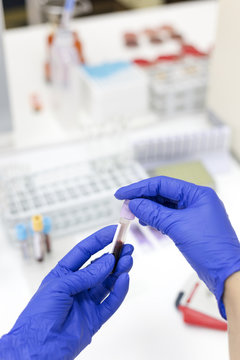 Blood samples being tested in a lab