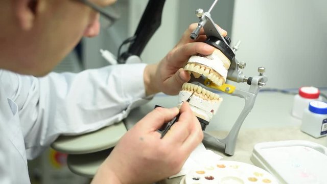 dental prosthesis work