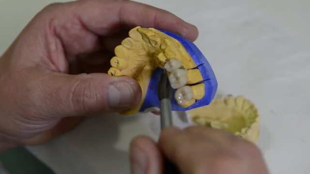 odontotecnico pulisce una forma di una dentiera