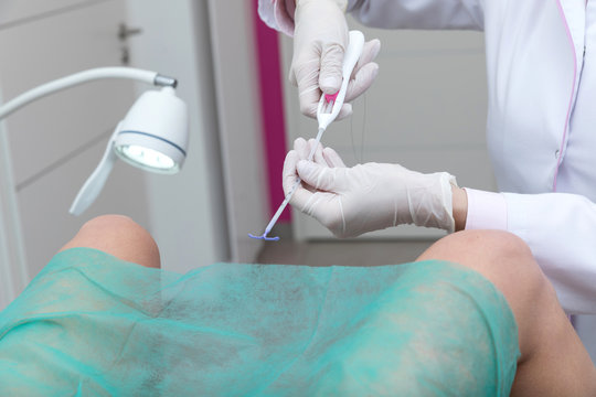 Intra Uterine Device, Gynecology consultation

