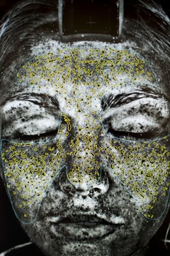 Image of young woman's face in skin clinic