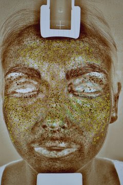 Image of young woman's face in skin clinic