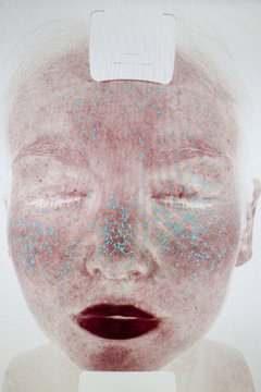 Image of young woman's face in skin clinic