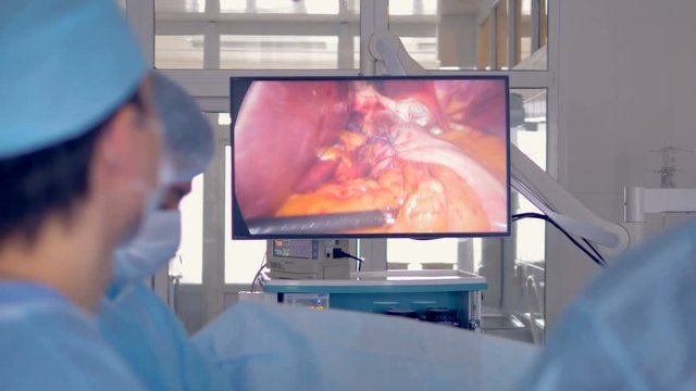 Close-up team of surgeons performing a surgery using an robotic equipment.