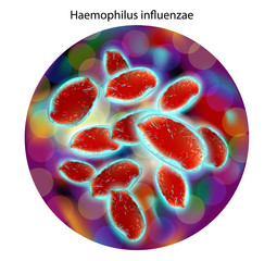 Haemophilus influenzae bacteria Gram-negative coccobacilli which cause infections mainly in children, pneumonia, otitis, meninitis