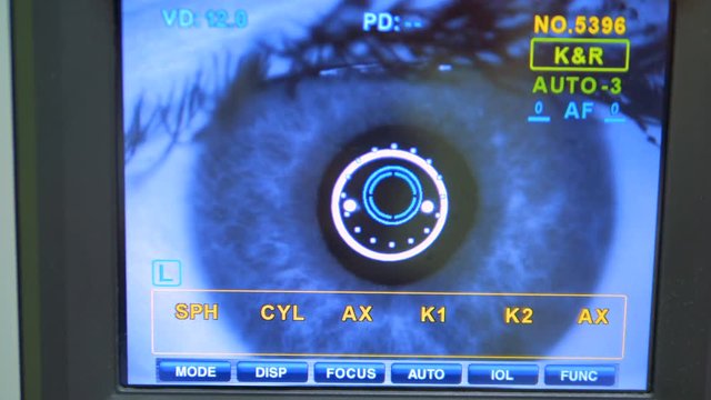 A retinal cameras screen checking.
