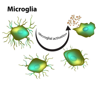 Activation of microglia.