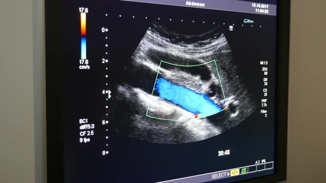 An original X-ray roentgenogram with multicolored organs of a client in a hospital in Ukraine. It resembles a liver.