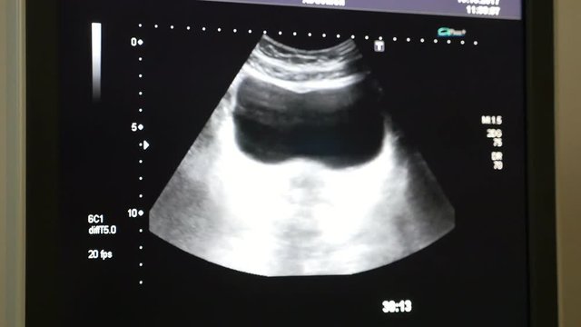 An impressive X-ray roentgenogram with moving organs of a client in a hospital in Ukraine. They look like a liver and stomack.