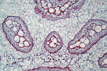 Fern stem under the microscope