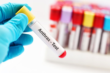 Test tube with blood sample for anthrax bacteria test