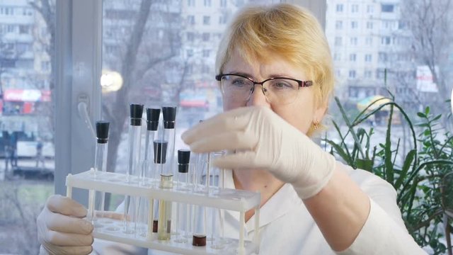 Medical worker makes analyses with tubes