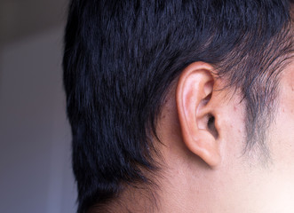 Obraz premium Earwax in ear close up,Healthcare and skin concept