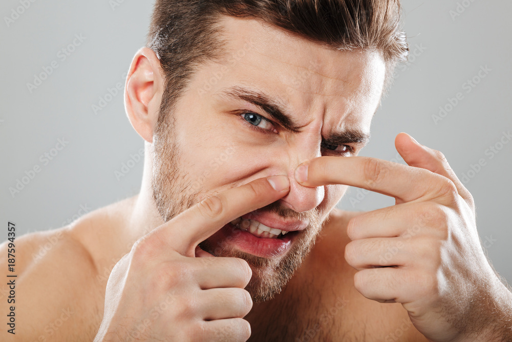 Wall mural Close up portrait of a man squeezing pimple on his face