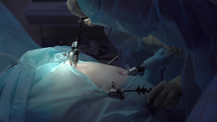 Operation using laparoscopic equipment. Surgeons team. Hospital.