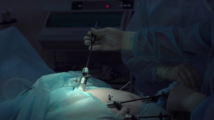 Operation using laparoscopic equipment. Surgeons team. Hospital.