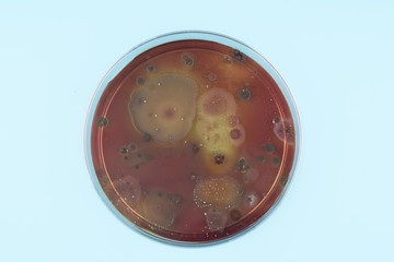  growth of microorganisms in a Petri dish, Bacteria, yeast and mold growing on an agar plate.