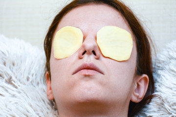 Redhead model using slices of potato to relieve her dark circles and puffy eyes
