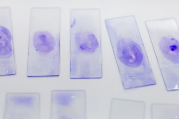 Technique Smear preparation of microbiology for education in Lab.