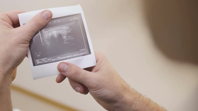 Man holds photo of ultrasound