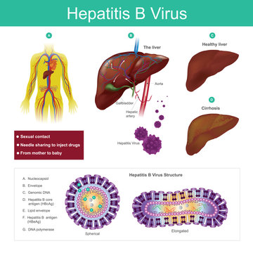 Hepatitis B virus. The virus is mainly transmitted by sexual contact, needle sharing to inject drugs and from mother to baby. Illustration.