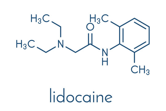 lidocaine local anesthetic drug molecule. Also known as xylocaine or lignocaine. Skeletal formula.