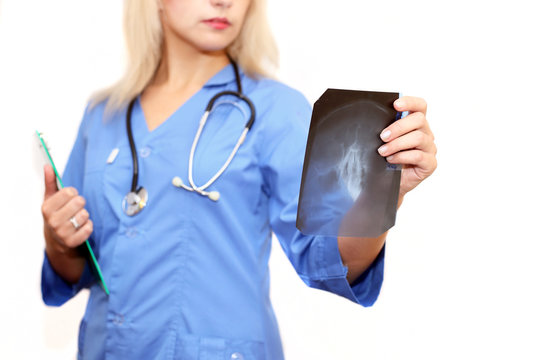 Young female doctor looking at x-ray image of head on white background