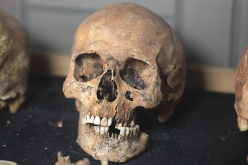 human skull - criminology museum detail