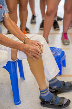 The Amputee Is Being Checked During Making New Plastic Prosthesis.