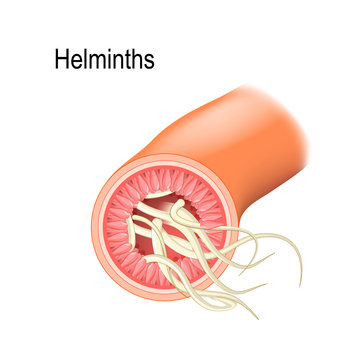 Helminths in the Small intestine.