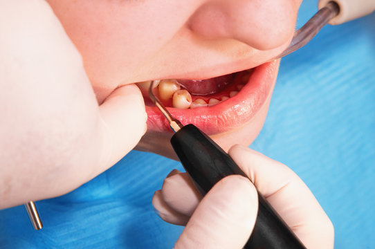 Dentist making patient's teeth hygiene
