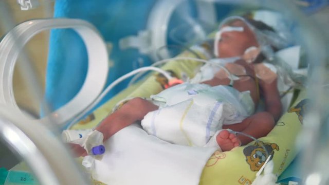 A skinny newborn baby connected to intensive care machinery. 