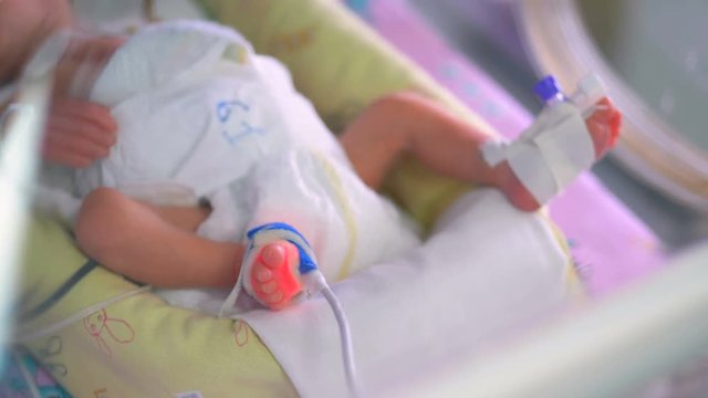 Skinny And Underweight Newborns Legs Connected To ICU Equipment. 