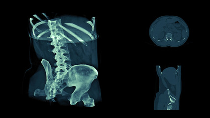 Body CT scan image, radiography x-ray examination, MRI tomography, 3d visualization of real body computed tomography scanning.