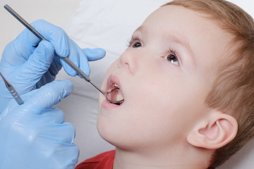 Medical examination of child patient teeth using a mirror by a dentist. Caries, tooth damage.