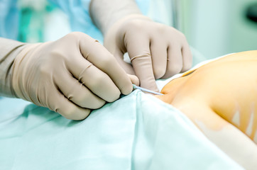 The process of setting the central catheter to the patient before the operation.
- 188415547