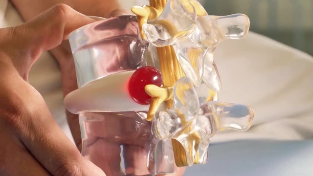 Model of the spine. Pain part.