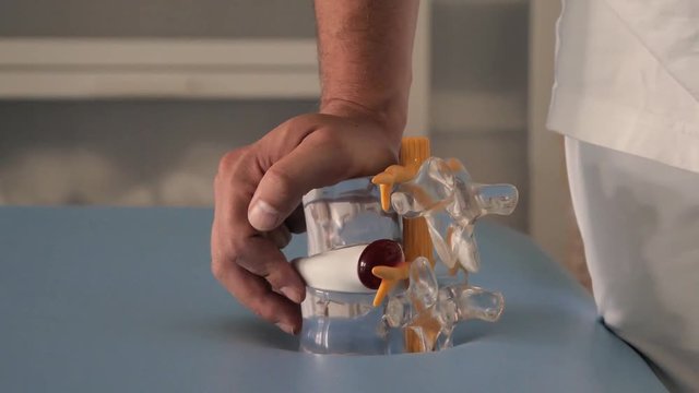 Model of the spine with pain area.
