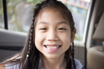 Little cute girl smile with her broken tooth