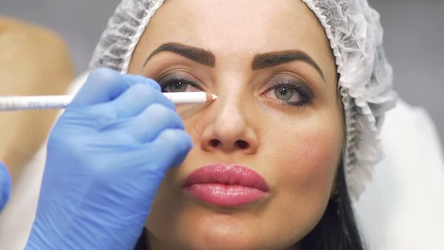 Beautician marks facial zones for future botox procedure
