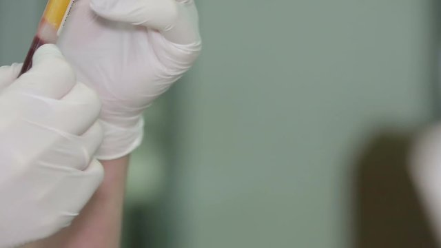 The laboratory staff examines a test tube with blood