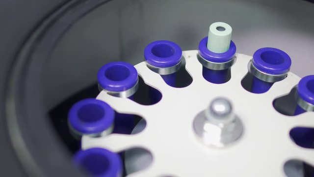 Doctor puts vial with vein blood in the centrifuge
