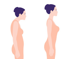 Young woman with a wrong posture. Spine. Profile. Vector illustration on white background. Minimalism