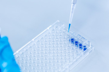 Biochemical analysis and Chemical analysis  in Lab.