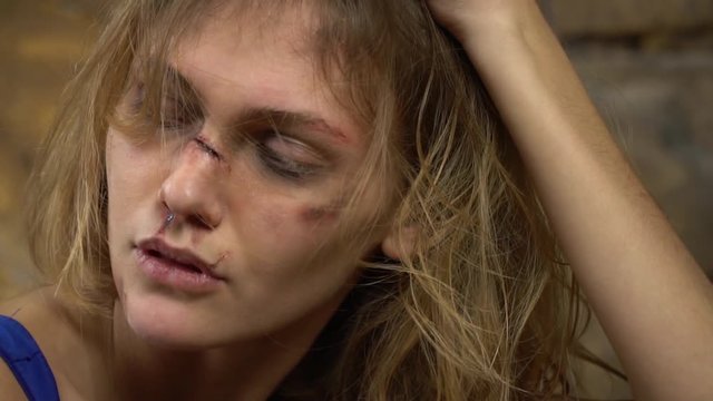 A girl with wounds on her face touches her hair, slow motion