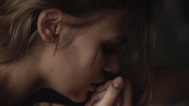 A girl with a scar on her cheek touches her finger to her lips