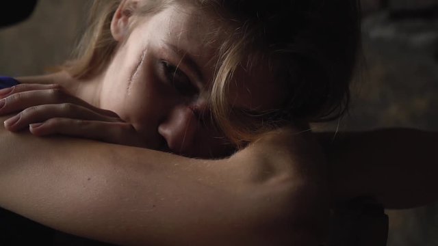 A girl with a scar on her cheek looks into the distance